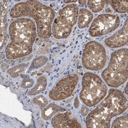 PTOP Antibody, Novus Biologicals 0.1mL; Unlabeled:Antibodies, Polyclonal